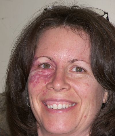Mickie Harshman