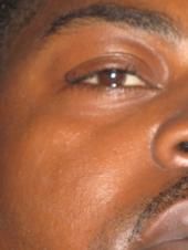 Jermaine Hickman