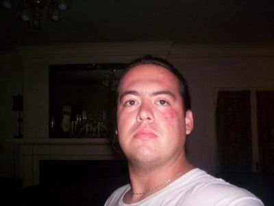 Joe Torrez