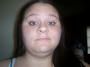 Kimberly Fillers