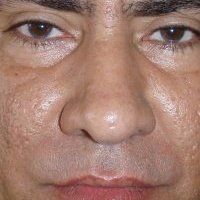Gilberto Bermudez