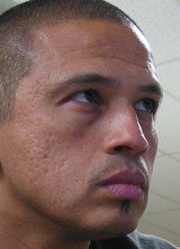 Anthony Yaranon