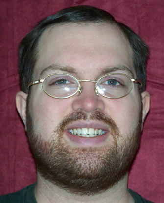 Billy Coleman