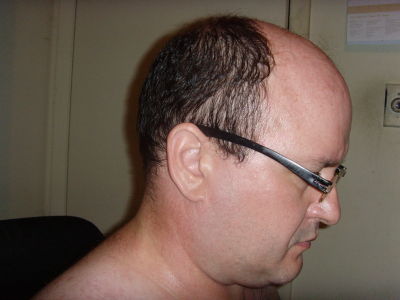 Nicholas Bozinovich