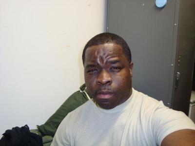 Demetrious Mack