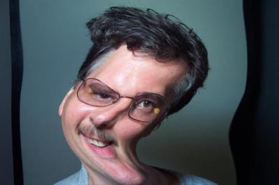 Bruce Blodgett