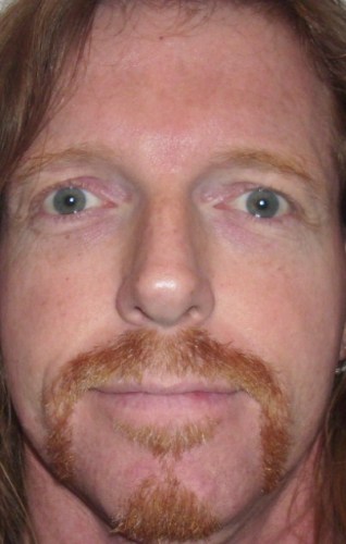 Robert Fries