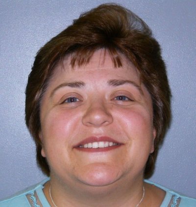 Esther Zellner