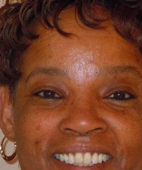 Shirley Lewis
