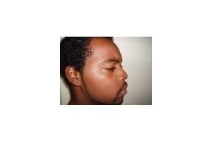 Rashawn Madison