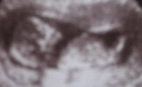 Debra Lesser