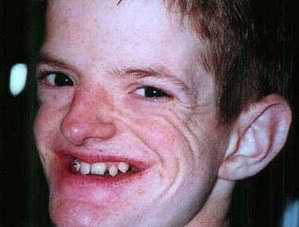 Bradley Tuyn