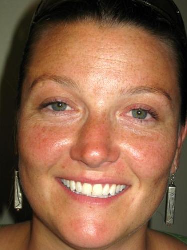 Morea Christenson