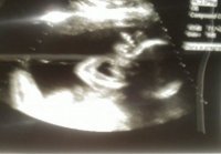Akia Pickett