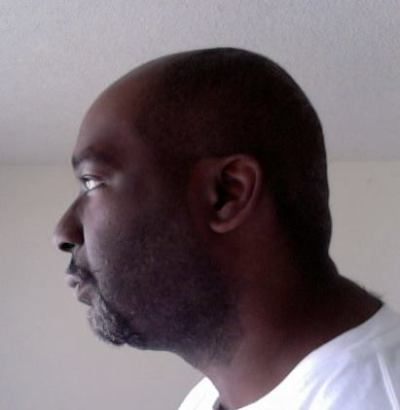 Lavelle Scales