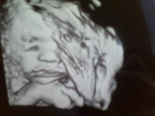 Bryon Uhle