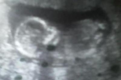 Junior Tennyson