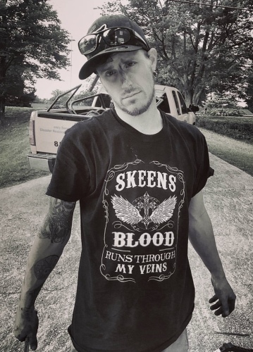 Brian Skeens
